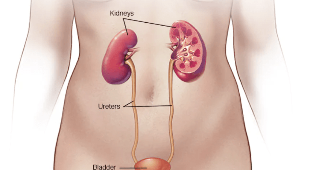 How to Treat UTI