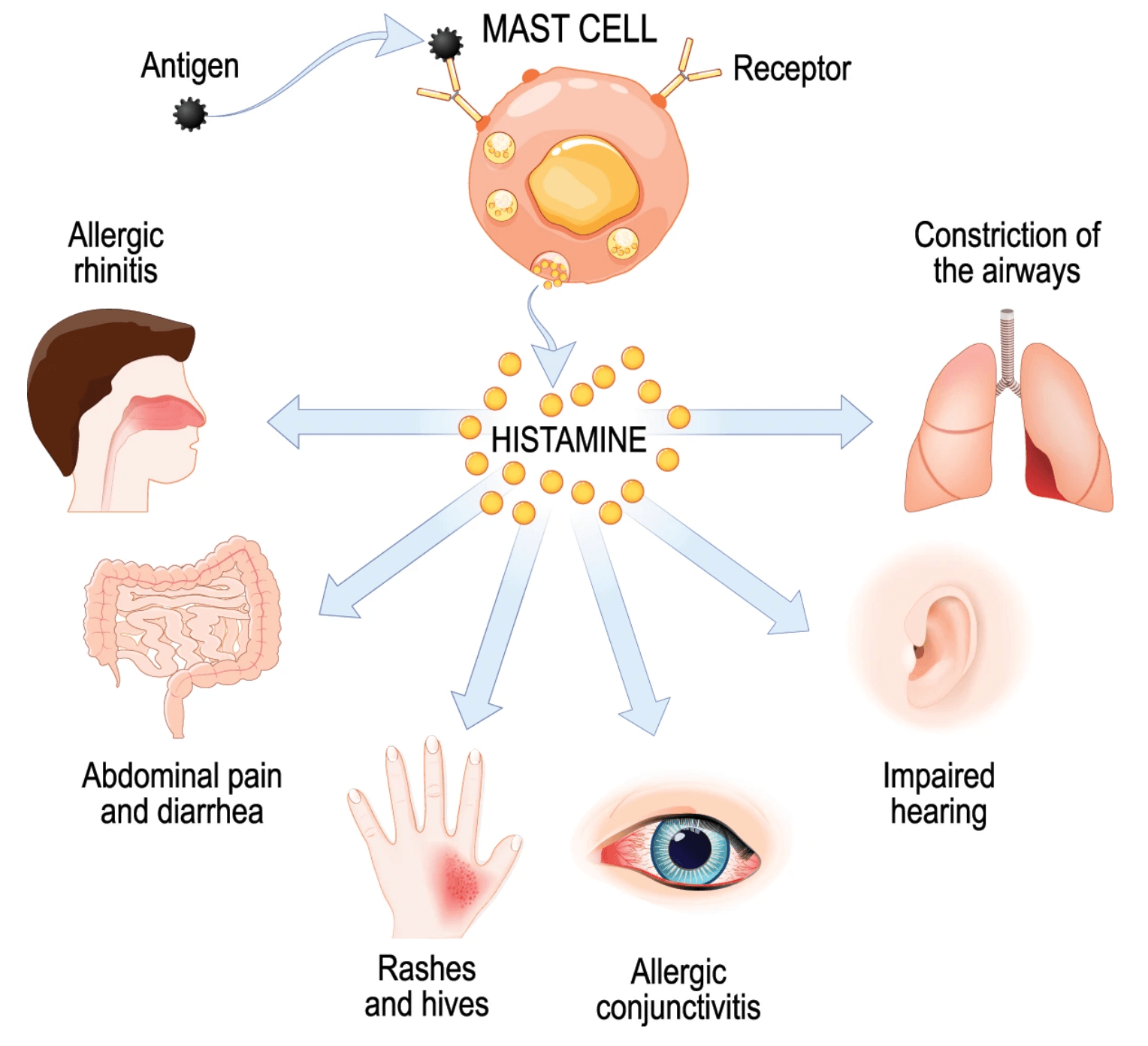 seasonal allergy symptoms